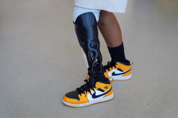 A boy shows off his 3-D printed prosthetic limb.